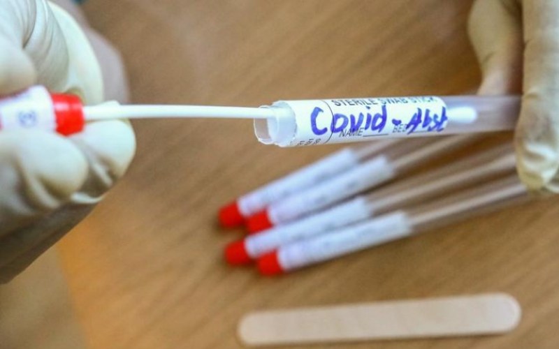 China rolls out anal swab Covid-19 test