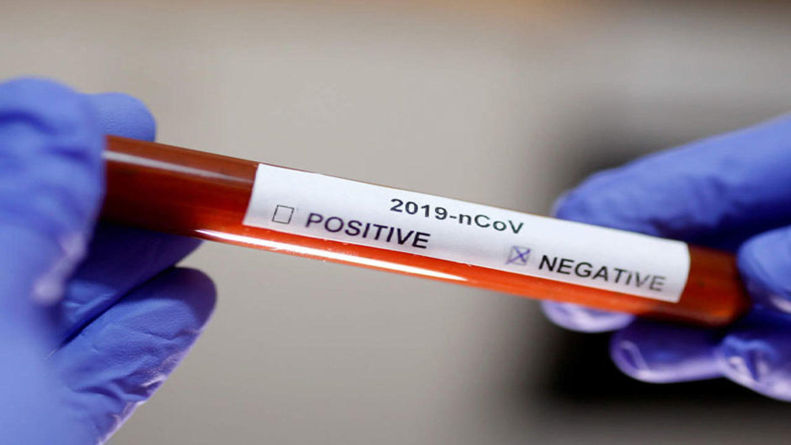 Kericho suspected case of Covid-19 tests negative
