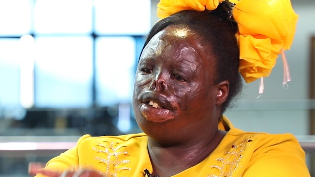  “I woke up in a mortuary after 3 days”, Kenya's post-election violence victim Joyce Chepkemoi speaks