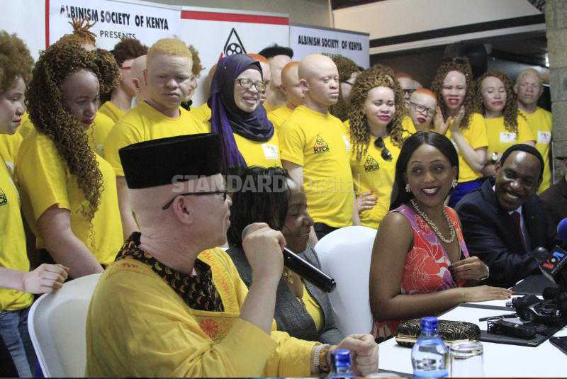 30 contenders set for albinism beauty pageant 