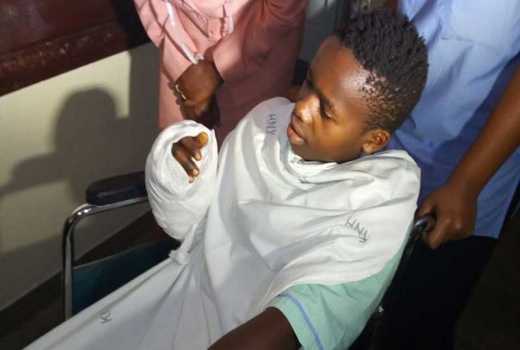 KNH doctors successfully reimplant patient's hand