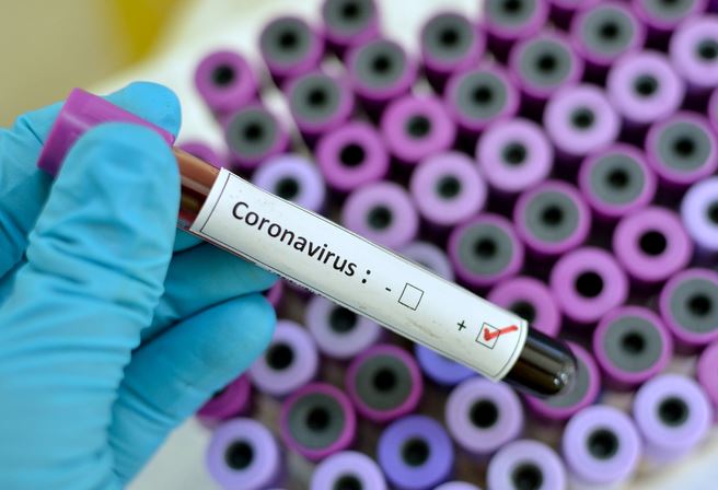 Coronavirus is becoming a burden to global economy