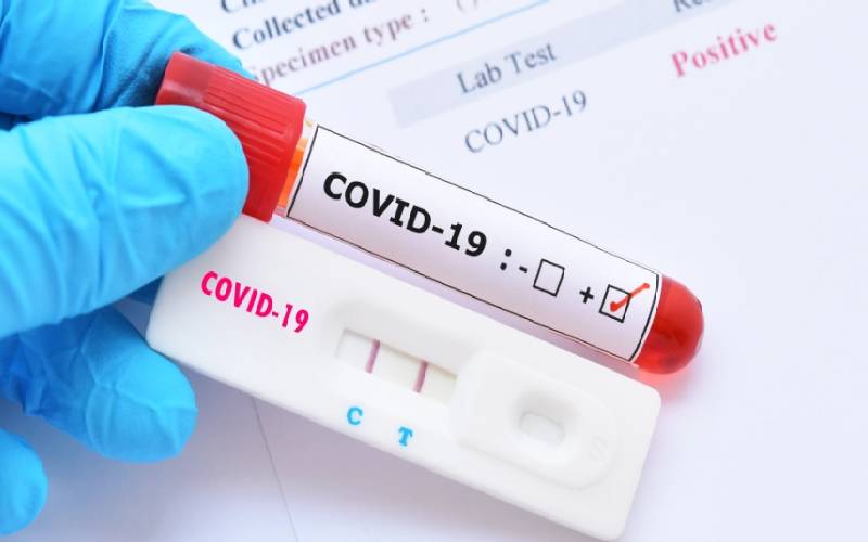 How nations can get cheaper Covid-19 tests