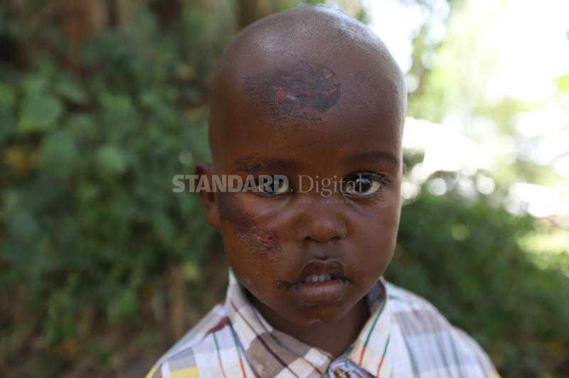 Three-year-old boy pushed out of a moving matatu