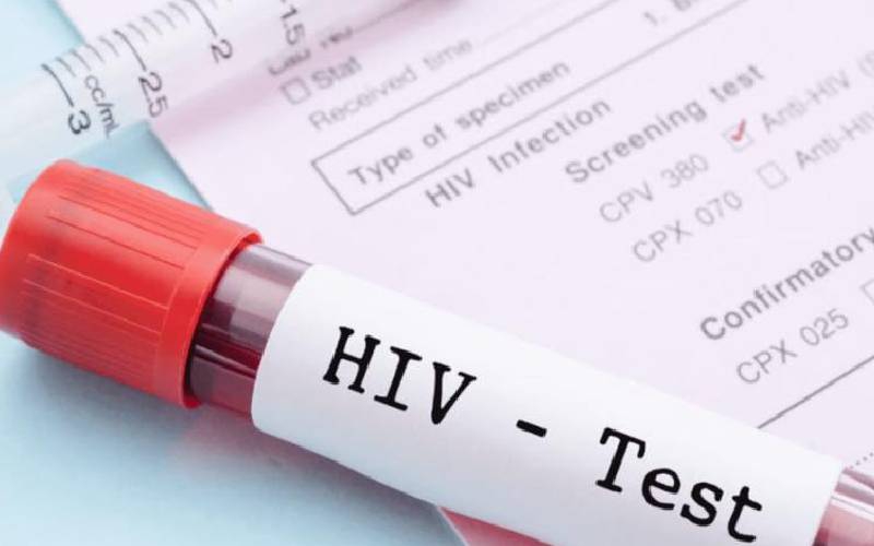 Promising anti-HIV/Aids research proves we have great untapped potential