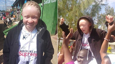 Top KCPE candidate defies stigma of albinism to emerge winner 