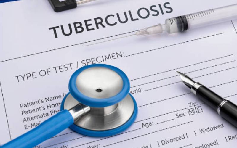 Why more needs to be done to avert TB burden in Kenya