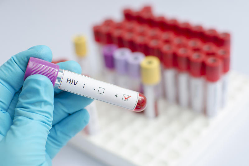 More turn to HIV self-testing kits, says Nascop data