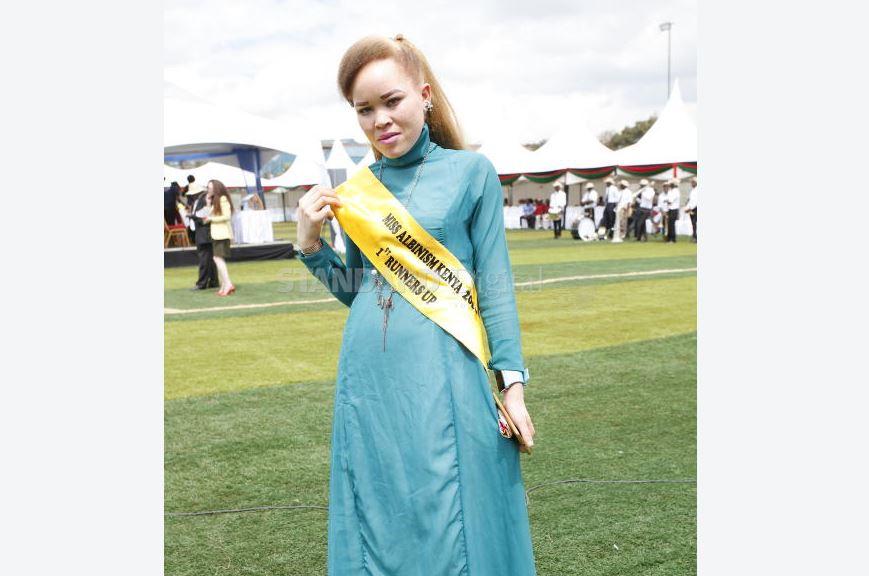 We went against all odds to embrace albinism