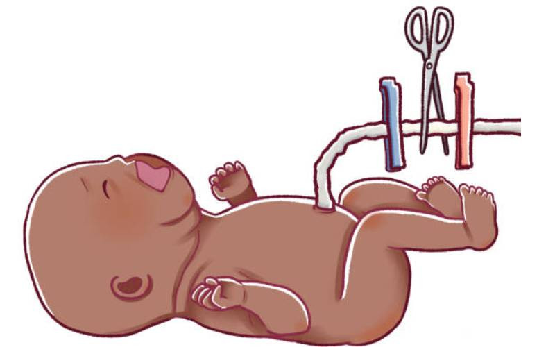 Clamping the umbilical cord straight after birth is bad for a