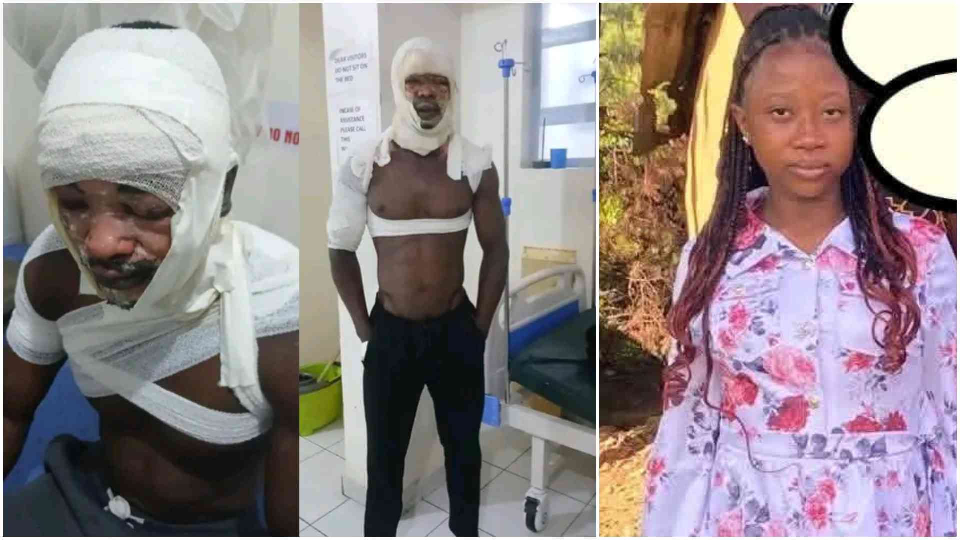Multimedia University student burnt, Sh300,000 allegedly stolen by girlfriend