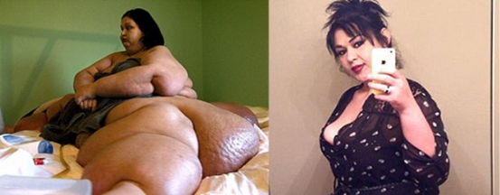 Mayra Rosales before and after shedding weight