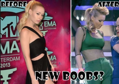 Iggy Azalea